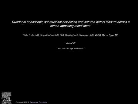 Duodenal endoscopic submucosal dissection and sutured defect closure across a lumen-apposing metal stent  Phillip S. Ge, MD, Hiroyuki Aihara, MD, PhD,