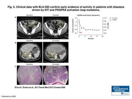 Fig. 5. Clinical data with BLU-285 confirm early evidence of activity in patients with diseases driven by KIT and PDGFRA activation loop mutations. Clinical.