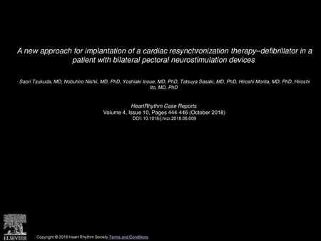 A new approach for implantation of a cardiac resynchronization therapy–defibrillator in a patient with bilateral pectoral neurostimulation devices  Saori.