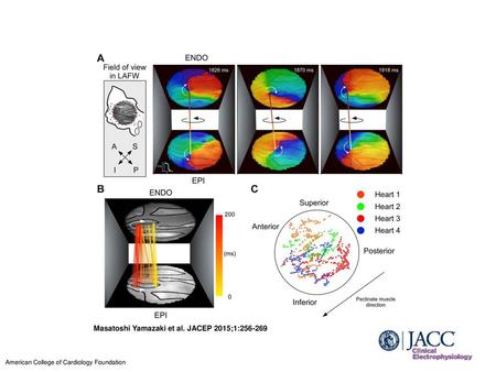 Masatoshi Yamazaki et al. JACEP 2015;1: