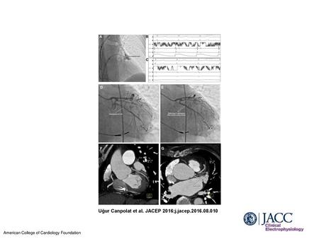 Uğur Canpolat et al. JACEP 2016;j.jacep