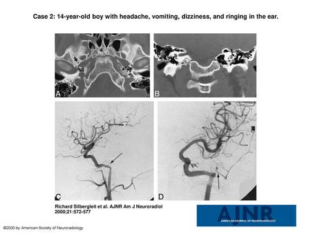 Case 2: 14-year-old boy with headache, vomiting, dizziness, and ringing in the ear. Case 2: 14-year-old boy with headache, vomiting, dizziness, and ringing.