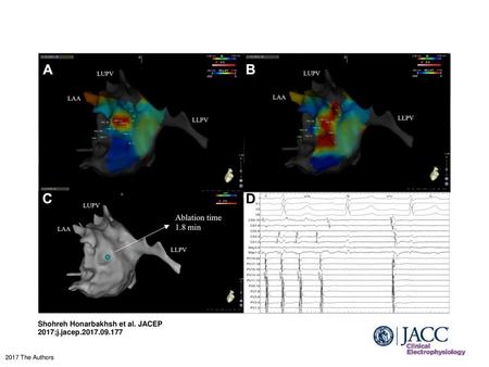 Shohreh Honarbakhsh et al. JACEP 2017;j.jacep