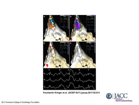 Konstantin Krieger et al. JACEP 2017;j.jacep