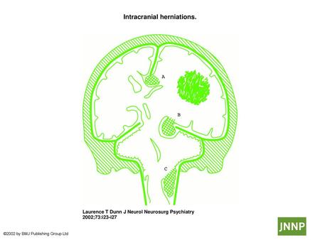 Intracranial herniations.