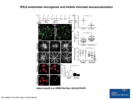 IFN‐β ameliorates microgliosis and inhibits choroidal neovascularization IFN‐β ameliorates microgliosis and inhibits choroidal neovascularization AExperimental.