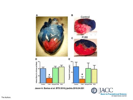 Jason A. Bartos et al. BTS 2016;j.jacbts