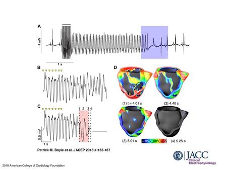 Patrick M. Boyle et al. JACEP 2018;4: