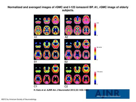 Normalized and averaged images of rGMC and I-123 iomazenil BP