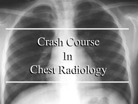 Crash Course In Chest Radiology.