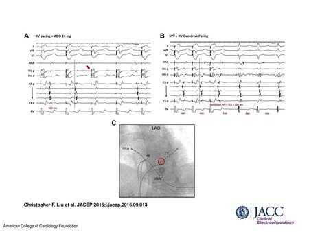 Christopher F. Liu et al. JACEP 2016;j.jacep