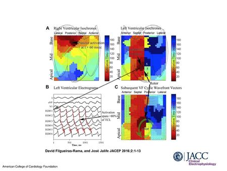 David Filgueiras-Rama, and José Jalife JACEP 2016;2:1-13