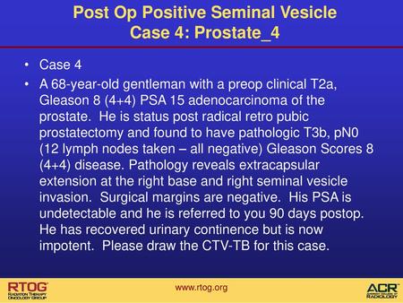 Post Op Positive Seminal Vesicle Case 4: Prostate_4