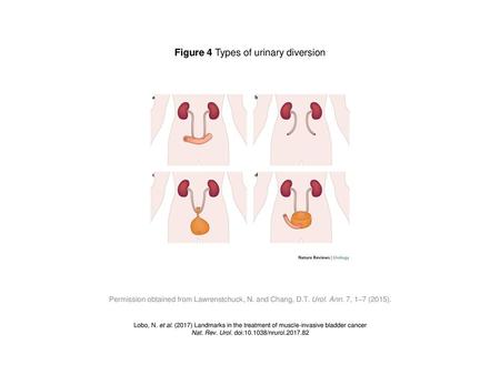 Figure 4 Types of urinary diversion