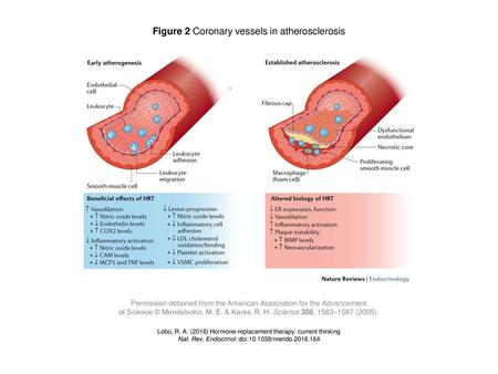 Figure 2 Coronary vessels in atherosclerosis