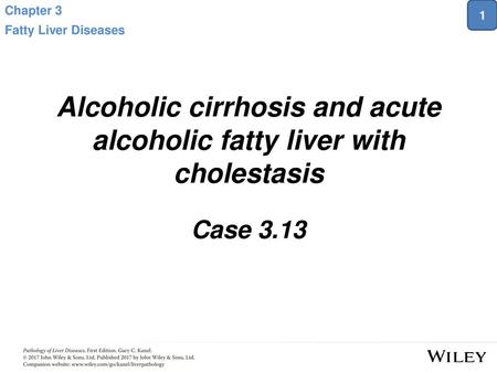 Alcoholic cirrhosis and acute alcoholic fatty liver with cholestasis