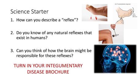 TURN IN YOUR INTEGUMENTARY DISEASE BROCHURE