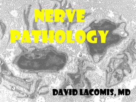 NERVE PATHOLOGY David Lacomis, MD.