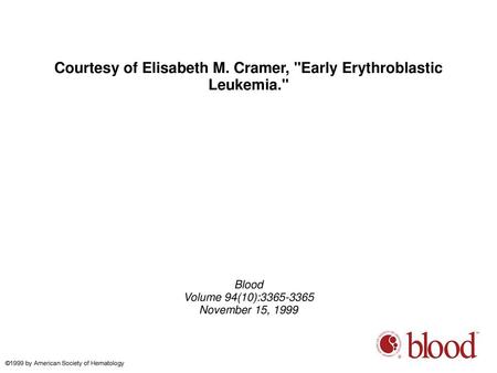 Courtesy of Elisabeth M. Cramer, Early Erythroblastic Leukemia.