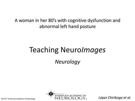 Teaching NeuroImages Neurology