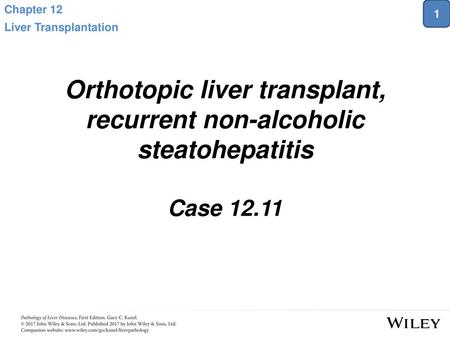 Orthotopic liver transplant, recurrent non-alcoholic steatohepatitis