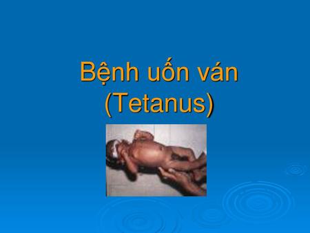 Bệnh uốn ván (Tetanus).