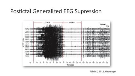 Postictal Generalized EEG Supression