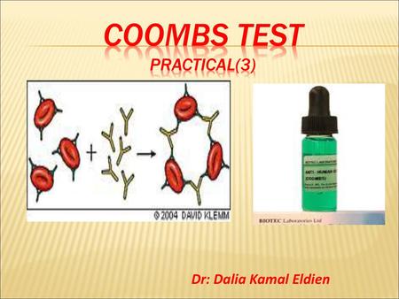 Coombs test practical(3)