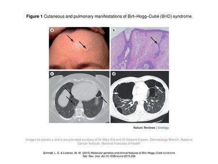 Nat. Rev. Urol. doi: /nrurol