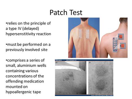 Patch Test relies on the principle of a type IV (delayed) hypersenstitivity reaction must be performed on a previously involved site comprises a series.