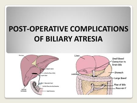 POST-OPERATIVE COMPLICATIONS