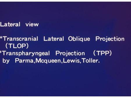 Ankylosis of TMJ Arthritis of TMJ Infectious arthritis Rheumatoid arthritis Degenerative arthritis Traumatic arthritis.