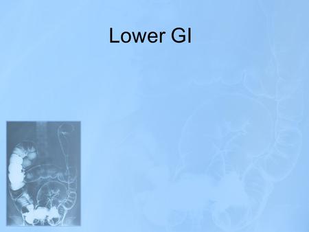 Lower GI.