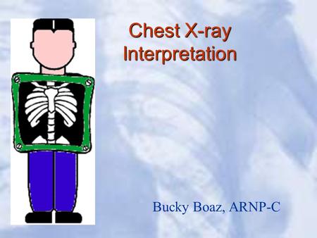 Chest X-ray Interpretation