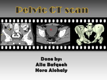  Pelvic CT.  Indications.  Contraindications.  Pelvic CT protocols. - Truma protocol. - Pathology protocol.  Patient after care.