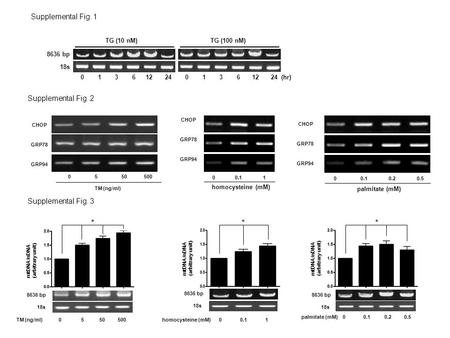 8636 bp 18s TG (10 nM) 0 1 3 6 12 24 TG (100 nM) 0 1 3 6 12 24 (hr) Supplemental Fig. 1 Supplemental Fig. 2 CHOP GRP78 GRP94 CHOP GRP78 GRP94 homocysteine.