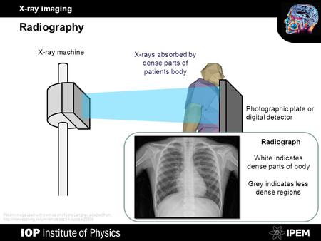 X-ray imaging Radiography Photographic plate or digital detector X-ray machine X-rays absorbed by dense parts of patients body White indicates dense parts.