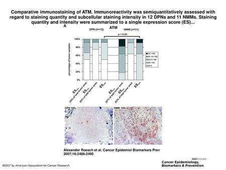 Comparative immunostaining of ATM