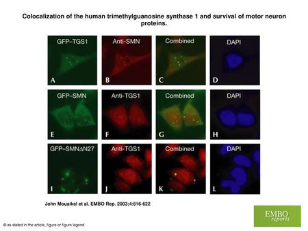 Colocalization of the human trimethylguanosine synthase 1 and survival of motor neuron proteins. Colocalization of the human trimethylguanosine synthase.