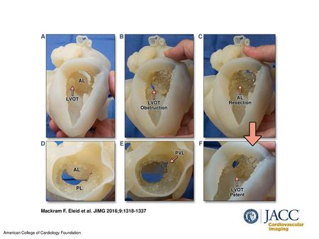 Mackram F. Eleid et al. JIMG 2016;9: