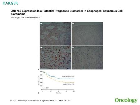 ZNF750 Expression Is a Potential Prognostic Biomarker in Esophageal Squamous Cell Carcinoma Oncology - DOI:10.1159/000484932 Fig. 1. The immunohistochemical.