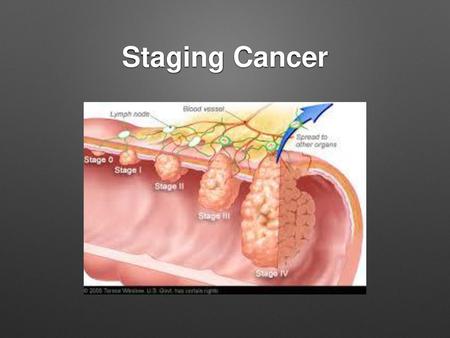 Staging Cancer.