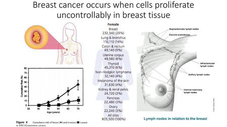 Breast cancer is the most common cancer among women