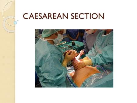 CAESAREAN SECTION.