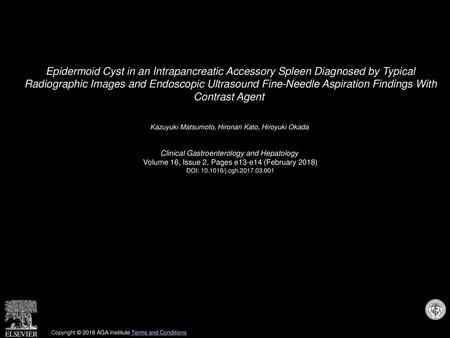 Epidermoid Cyst in an Intrapancreatic Accessory Spleen Diagnosed by Typical Radiographic Images and Endoscopic Ultrasound Fine-Needle Aspiration Findings.