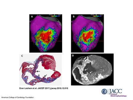 Eran Leshem et al. JACEP 2017;j.jacep