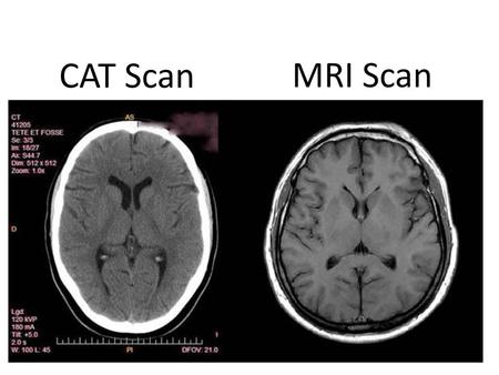 CAT Scan MRI Scan.