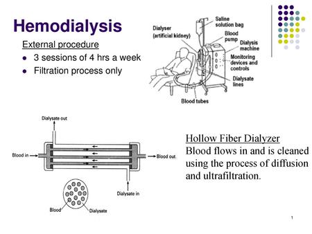 Hemodialysis Hollow Fiber Dialyzer Blood flows in and is cleaned