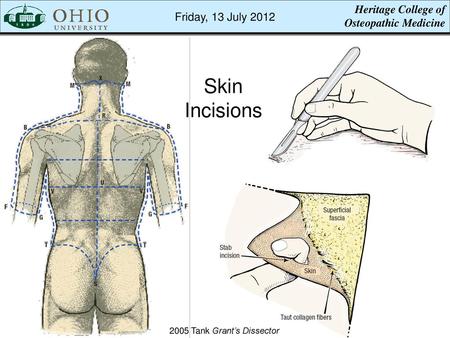 Skin Incisions Heritage College of Friday, 13 July 2012