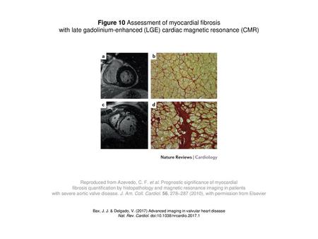 Figure 10 Assessment of myocardial fibrosis